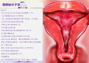 第44頁圖