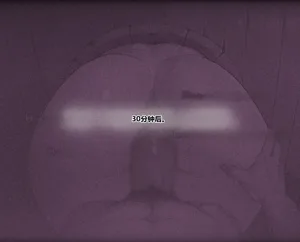 第183页图