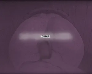 第188页图