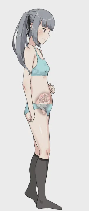 第178页图